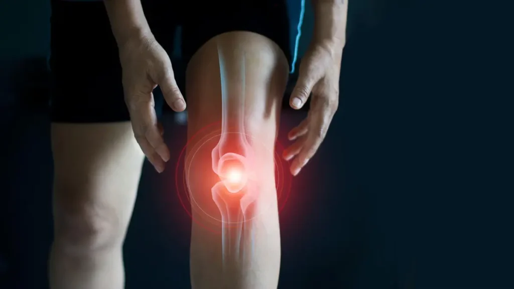 دور غير متوقع لأدوية علاج السمنة في إصلاح خشونة الركبة